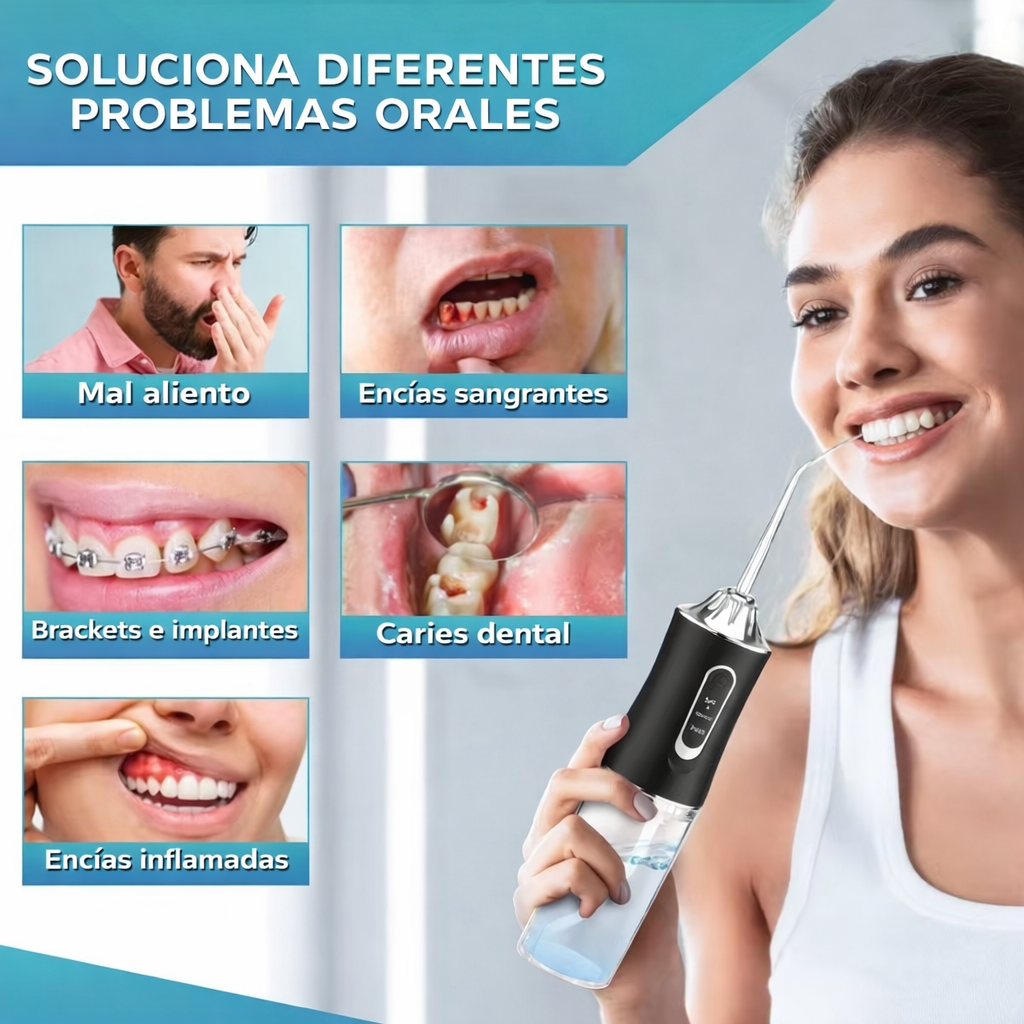 Irrigador Dental Eléctrico F600 Recargable – Limpieza Profunda, Portátil e Impermeable (4 Boquillas)