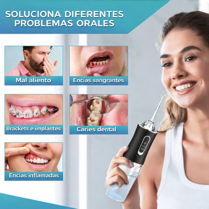 Irrigador Dental Eléctrico F600 Recargable – Limpieza Profunda, Portátil e Impermeable (4 Boquillas)